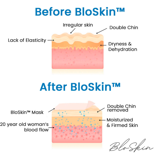 The BloSkin™ Lift : Say goodbye to your double chin now 2